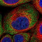 GIGYF1 Polyclonal Antibody