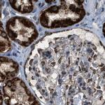 HIBADH Antibody in Immunohistochemistry (IHC)