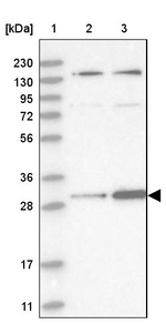 HIBADH Antibody in Western Blot (WB)