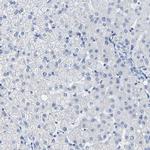 MYBPC1 Antibody in Immunohistochemistry (IHC)