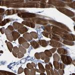 MYBPC1 Antibody in Immunohistochemistry (IHC)