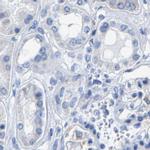 MYBPC1 Antibody in Immunohistochemistry (IHC)