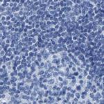 MYBPC1 Antibody in Immunohistochemistry (IHC)