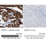 MYBPC1 Antibody