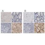 MURC Antibody in Immunohistochemistry (IHC)