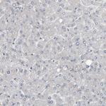 MURC Antibody in Immunohistochemistry (IHC)