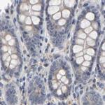 MURC Antibody in Immunohistochemistry (IHC)