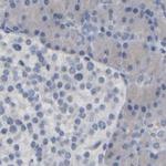 MURC Antibody in Immunohistochemistry (IHC)