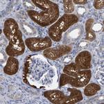 ALAD Antibody in Immunohistochemistry (Paraffin) (IHC (P))