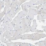 ALAD Antibody in Immunohistochemistry (Paraffin) (IHC (P))