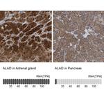 ALAD Antibody