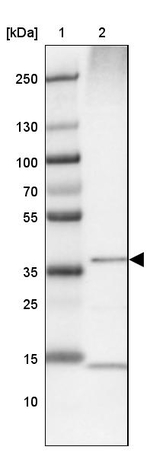 ALAD Antibody in Western Blot (WB)