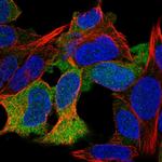 KIAA0895 Polyclonal Antibody