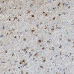 KIAA0895 Antibody in Immunohistochemistry (Paraffin) (IHC (P))