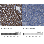ALDH1B1 Antibody in Immunohistochemistry (Paraffin) (IHC (P))
