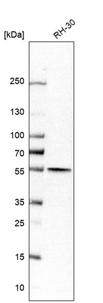 ALDH1B1 Antibody in Western Blot (WB)