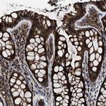 TCP-1 theta Antibody in Immunohistochemistry (Paraffin) (IHC (P))
