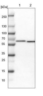 TCP-1 theta Antibody in Western Blot (WB)
