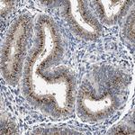 TPST2 Antibody in Immunohistochemistry (Paraffin) (IHC (P))