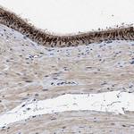 TPST2 Antibody in Immunohistochemistry (Paraffin) (IHC (P))