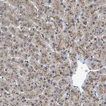 TPST2 Antibody in Immunohistochemistry (Paraffin) (IHC (P))