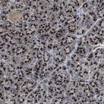 TPST2 Polyclonal Antibody