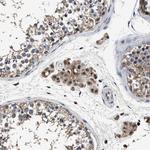 TPST2 Antibody in Immunohistochemistry (Paraffin) (IHC (P))