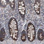 TECPR1 Antibody in Immunohistochemistry (Paraffin) (IHC (P))