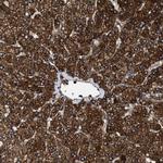 TPP2 Polyclonal Antibody