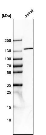 TPP2 Antibody in Western Blot (WB)