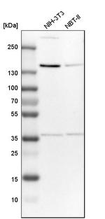 TPP2 Antibody in Western Blot (WB)