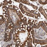 RGP1 Antibody in Immunohistochemistry (Paraffin) (IHC (P))