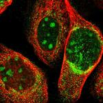 ZCCHC7 Polyclonal Antibody