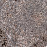 ZCCHC7 Antibody in Immunohistochemistry (IHC)