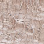 ZCCHC7 Antibody in Immunohistochemistry (IHC)