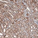 ZCCHC7 Antibody in Immunohistochemistry (IHC)