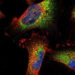 TRPC1 Antibody in Immunocytochemistry (ICC/IF)