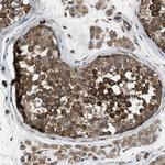 TRPC1 Antibody in Immunohistochemistry (Paraffin) (IHC (P))