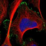 TMEM53 Polyclonal Antibody