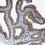 TMEM53 Antibody in Immunohistochemistry (IHC)