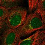 ZNF461 Polyclonal Antibody