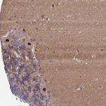 ZNF461 Antibody in Immunohistochemistry (Paraffin) (IHC (P))