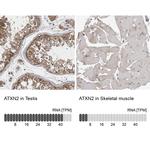 Ataxin 2 Antibody in Immunohistochemistry (IHC)