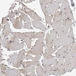 Ataxin 2 Antibody in Immunohistochemistry (IHC)