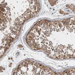 Ataxin 2 Antibody in Immunohistochemistry (IHC)