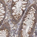 Ataxin 2 Antibody in Immunohistochemistry (IHC)