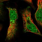 PDP1 Polyclonal Antibody