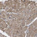 PDP1 Antibody in Immunohistochemistry (Paraffin) (IHC (P))