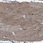 PDP1 Antibody in Immunohistochemistry (Paraffin) (IHC (P))