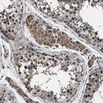 PDP1 Antibody in Immunohistochemistry (Paraffin) (IHC (P))